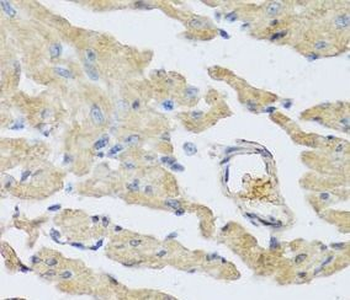 UCN2 Rabbit Polyclonal Antibody