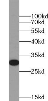 UCP1 Rabbit Polyclonal Antibody