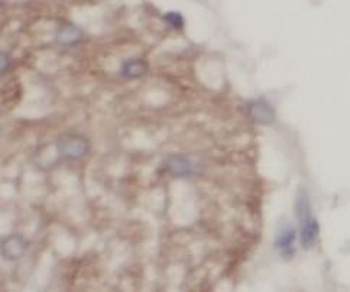 UCP1 Rabbit Polyclonal Antibody