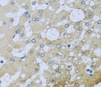 UQCR10 Rabbit Polyclonal Antibody
