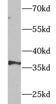 UFD1 Rabbit Polyclonal Antibody