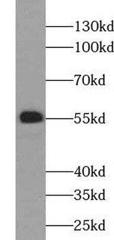 UGCG Rabbit Polyclonal Antibody
