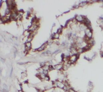 UGCG Rabbit Polyclonal Antibody