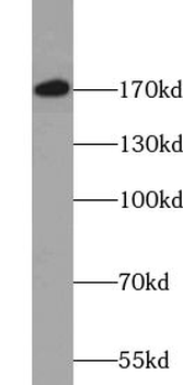 UGGT2 Rabbit Polyclonal Antibody