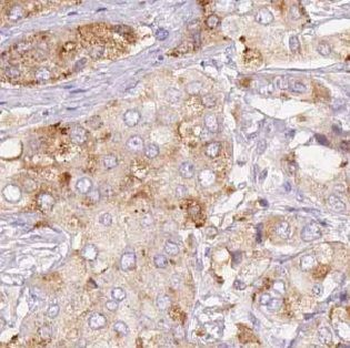 UHMK1 Rabbit Polyclonal Antibody