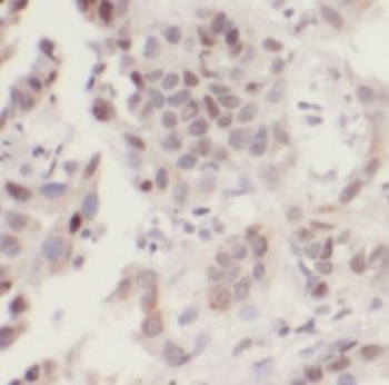 UHRF1 Rabbit Polyclonal Antibody