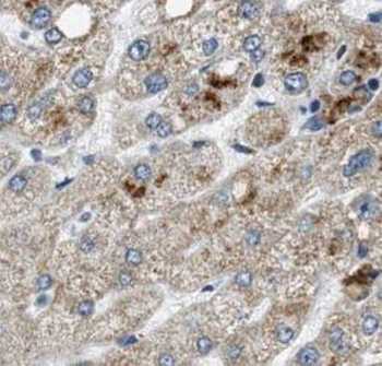 ULBP1 Rabbit Polyclonal Antibody