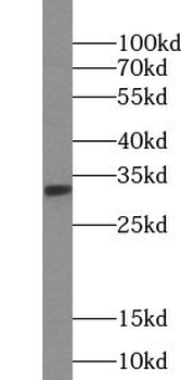 ULBP2 Rabbit Polyclonal Antibody