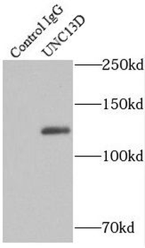 UNC13D Rabbit Polyclonal Antibody