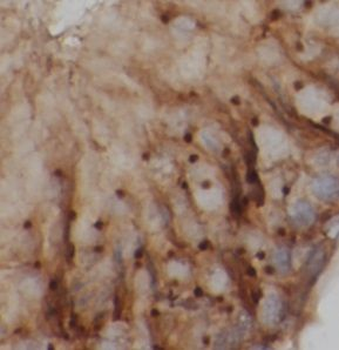 UNC13D Rabbit Polyclonal Antibody