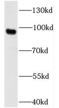 UNC5A Rabbit Polyclonal Antibody