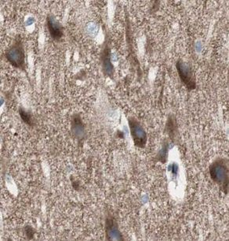 UNC5A Rabbit Polyclonal Antibody