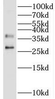 UNG Rabbit Polyclonal Antibody