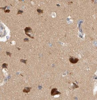 UNG Rabbit Polyclonal Antibody