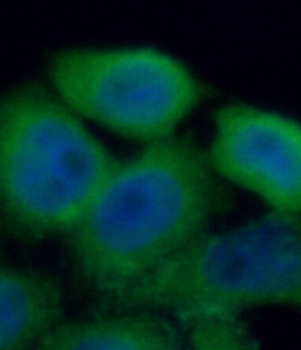 PLAU Rabbit Polyclonal Antibody