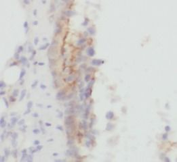 PLAU Rabbit Polyclonal Antibody