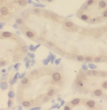UPF1 Rabbit Polyclonal Antibody