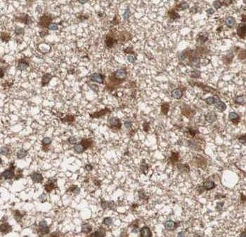 URGCP Rabbit Polyclonal Antibody