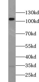 USP11 Rabbit Polyclonal Antibody