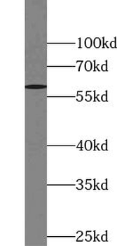 USP14 Rabbit Polyclonal Antibody