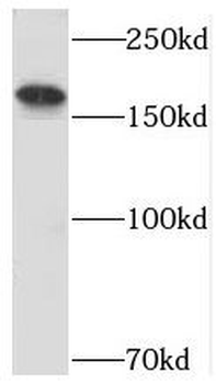 USP32 Rabbit Polyclonal Antibody