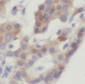 USP32 Rabbit Polyclonal Antibody