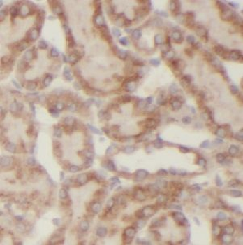 USP33 Rabbit Polyclonal Antibody