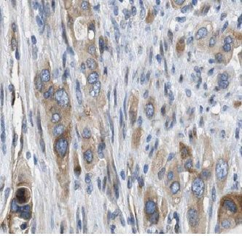 USP9X Rabbit Polyclonal Antibody