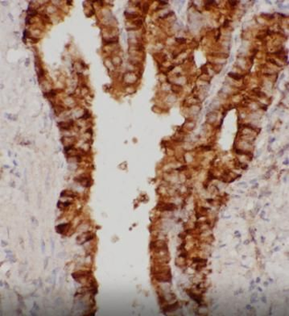 SCGB1A1 Rabbit Polyclonal Antibody