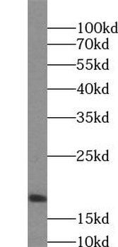 UXT Rabbit Polyclonal Antibody