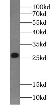 V5 tag Rabbit Polyclonal Antibody