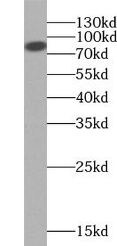 VAC14 Rabbit Polyclonal Antibody
