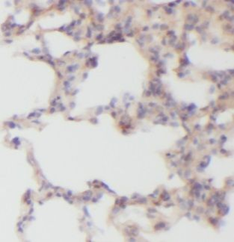 VAC14 Rabbit Polyclonal Antibody