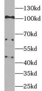 VCAM1 Rabbit Polyclonal Antibody