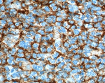VCAM1 Rabbit Polyclonal Antibody