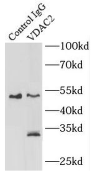 VDAC2 Rabbit Polyclonal Antibody