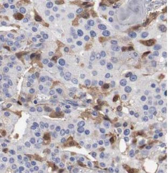 VDAC2 Rabbit Polyclonal Antibody