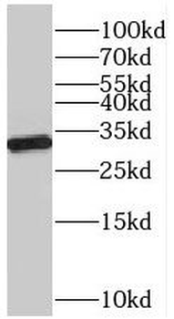 VDAC2 Rabbit Polyclonal Antibody