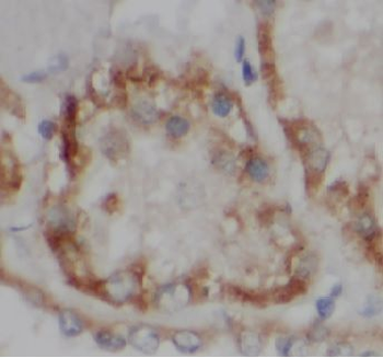 VDAC2 Rabbit Polyclonal Antibody