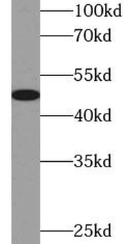 VDR Rabbit Polyclonal Antibody