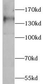 FLT1 Rabbit Polyclonal Antibody