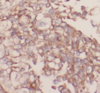 FLT1 Rabbit Polyclonal Antibody