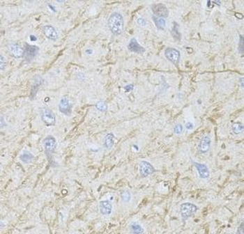 SLC32A1 Rabbit Polyclonal Antibody