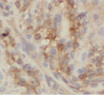 VIL1 Mouse Monoclonal Antibody