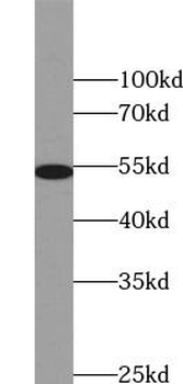 VIM Rabbit Polyclonal Antibody