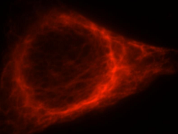 VIM Rabbit Polyclonal Antibody