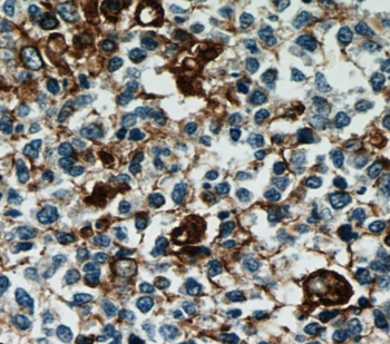 VIM Rabbit Polyclonal Antibody