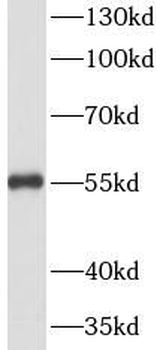 VIM Rabbit Polyclonal Antibody