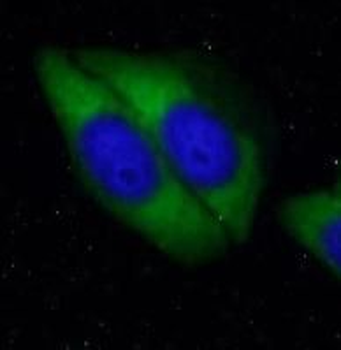 VIM Rabbit Polyclonal Antibody