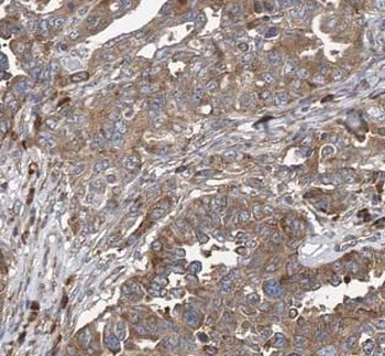 VIM Rabbit Polyclonal Antibody